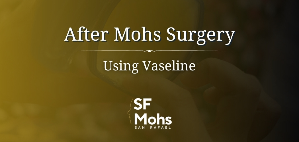 Using Vaseline After Mohs Surgery