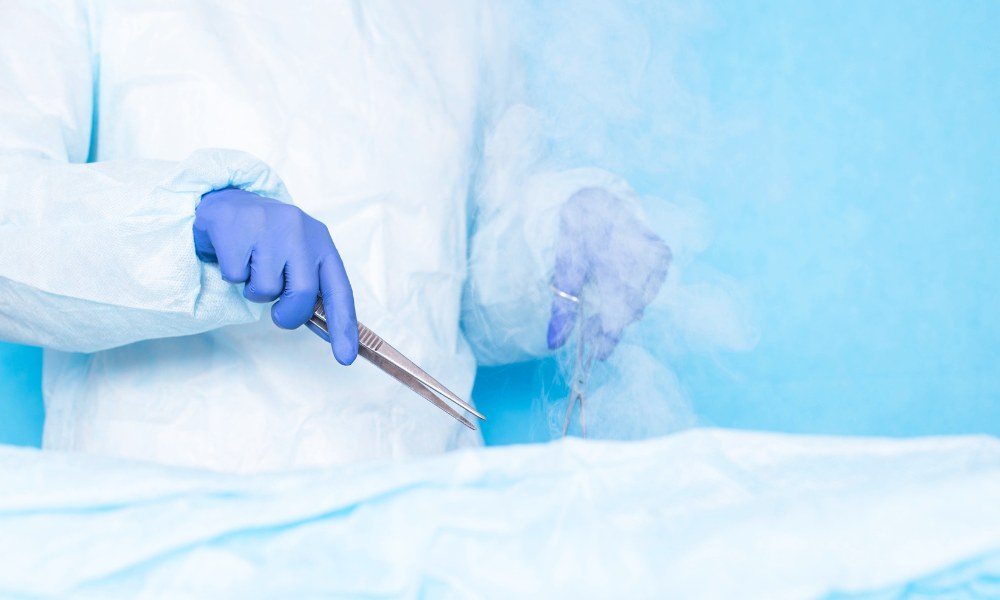 Doctor performing cryosurgery